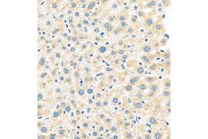 Immunohistochemistry of paraffin embedded mouse liver using MUC20 (ABIN7074692) at dilution of 1:1000 (400x lens) (MUC20 Antikörper)