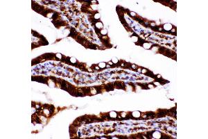 Anti-Caspase3 antibody, IHC(P) IHC(P): Rat Intestine Tissue