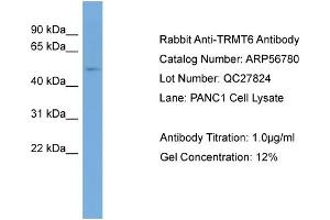 WB Suggested Anti-TRMT6  Antibody Titration: 0. (TRMT6 Antikörper  (Middle Region))