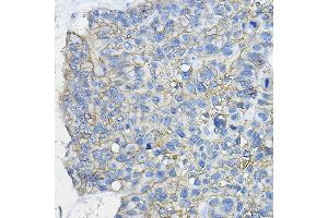 Immunohistochemistry (IHC) image for anti-CD46 (CD46) (AA 40-320) antibody (ABIN1512715)