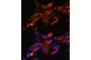 Immunofluorescence analysis of NIH-3T3 cells using Src Rabbit mAb (ABIN7269727) at dilution of 1:100 (40x lens). (Src Antikörper)