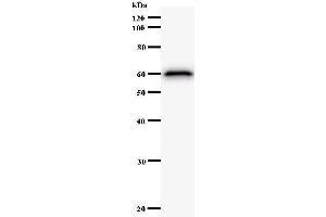 Western Blotting (WB) image for anti-Lysine (K)-Specific Demethylase 4A (KDM4A) antibody (ABIN932195) (KDM4A Antikörper)