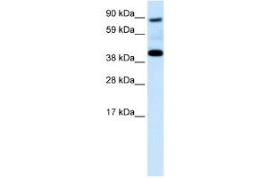 Western Blotting (WB) image for anti-serpin Peptidase Inhibitor, Clade F (Alpha-2 Antiplasmin, Pigment Epithelium Derived Factor), Member 1 (SERPINF1) (N-Term) antibody (ABIN926996)