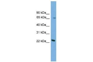 WB Suggested Anti-Foxn2 Antibody Titration:  0. (FOXN2 Antikörper  (N-Term))