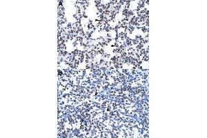 Immunohistochemical staining (Formalin-fixed paraffin-embedded sections) of human lung (A) and human spleen (B) with GCM1 polyclonal antibody  at 4-8 ug/mL working concentration.