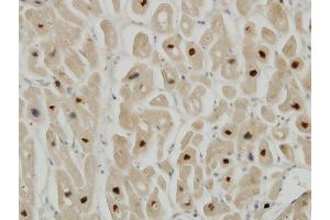 Immunoperoxidase of monoclonal antibody to TTN on formalin-fixed paraffin-embedded human heart. (Titin Antikörper  (AA 1-110))