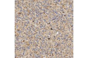 IHC analysis of EIF2AK1 using anti-EIF2AK1 antibody (ABIN7601508).