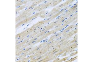 Immunohistochemistry of paraffin-embedded rat heart using CLIP1 antibody (ABIN5975170) at dilution of 1/100 (40x lens). (CLIP1 Antikörper)
