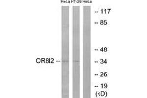 Western Blotting (WB) image for anti-Olfactory Receptor, Family 8, Subfamily I, Member 2 (OR8I2) (AA 55-104) antibody (ABIN2891056) (OR8I2 Antikörper  (AA 55-104))