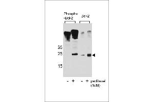 Western blot analysis of extracts from Jurkat cells,untreated or treated with paclitaxel,using phospho-Bcl2(Ser70)(left) or Bcl2 Antibody (right). (Bcl-2 Antikörper  (pSer70))