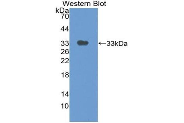 Thymidine Phosphorylase Antikörper  (AA 29-305)