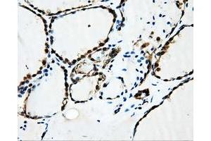 Image no. 3 for anti-Sorbitol Dehydrogenase (SORD) antibody (ABIN1501076)