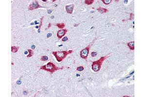 Anti-KIF5A antibody IHC of human brain, cortex. (KIF5A Antikörper  (Internal Region))
