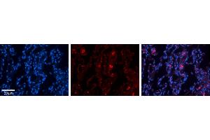 Rabbit Anti-FBXO21 Antibody     Formalin Fixed Paraffin Embedded Tissue: Human Lung Tissue  Observed Staining: Membrane and cytoplasmic in alveolar type I cells  Primary Antibody Concentration: 1:100  Other Working Concentrations: 1/600  Secondary Antibody: Donkey anti-Rabbit-Cy3  Secondary Antibody Concentration: 1:200  Magnification: 20X  Exposure Time: 0. (FBXO21 Antikörper  (N-Term))