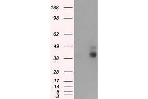 HEK293T cells were transfected with the pCMV6-ENTRY control (Left lane) or pCMV6-ENTRY BSG (Right lane) cDNA for 48 hrs and lysed. (CD147 Antikörper)