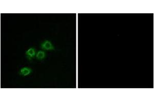 Immunofluorescence analysis of MCF7 cells, using GPR1 Antibody. (G Protein-Coupled Receptor 1 Antikörper  (AA 121-170))