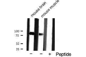 Western blot analysis of Catenin-γ expression in mouse tissue extract (JUP Antikörper  (C-Term))
