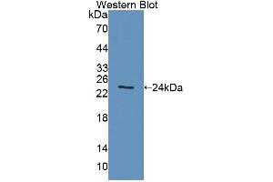Western blot analysis of the recombinant protein. (ACADS Antikörper  (AA 210-396))