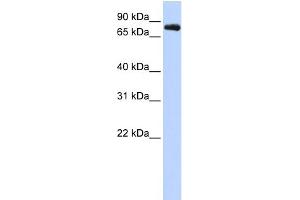 WB Suggested Anti-KCNC3 Antibody Titration:  0. (KCNC3 Antikörper  (Middle Region))