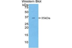 Western Blotting (WB) image for anti-Pyruvate Dehydrogenase Kinase, Isozyme 4 (PDK4) (AA 117-387) antibody (ABIN1860175) (PDK4 Antikörper  (AA 117-387))