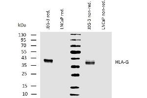 Western blotting analysis of human HLA-G using mouse monoclonal antibody MEM-G/1 on lysates of JEG-3 cell line and LNCaP cell line (negative control) under reducing and non-reducing conditions. (HLAG Antikörper)