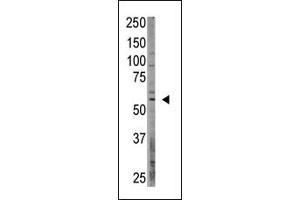 Western Blotting (WB) image for anti-CAMP Responsive Element Binding Protein 3-Like 1 (CREB3L1) (AA 490-519), (C-Term) antibody (ABIN358719)