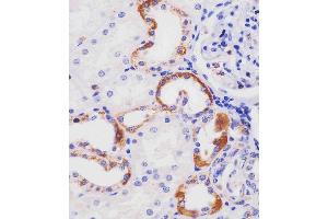 Immunohistochemistry (Paraffin-embedded Sections) (IHC (p)) image for anti-HERV-H LTR-Associating 2 (HHLA2) (AA 58-87) antibody (ABIN654607)