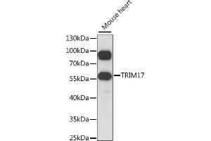 Western blot analysis of extracts of mouse heart, using TRIM17 antibody  at 1:1000 dilution. (TRIM17 / RNF16 Antikörper  (AA 1-300))