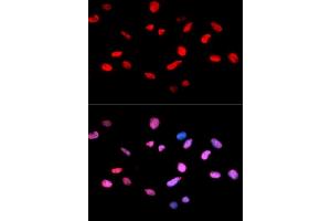 Immunofluorescence analysis of U2OS cells using Phospho-Rb-S811 antibody. (Retinoblastoma 1 Antikörper  (pSer811))