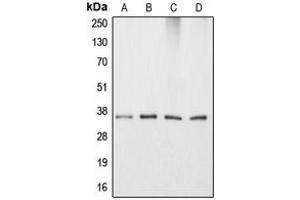 Western blot analysis of Apolipoprotein E expression in HeLa (A), HepG2 (B), NIH3T3 (C), PC12 (D) whole cell lysates. (APOE Antikörper  (Center))