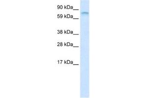 Western Blotting (WB) image for anti-Far Upstream Element (FUSE) Binding Protein 1 (FUBP1) antibody (ABIN2461190) (FUBP1 Antikörper)