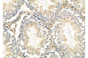 ABIN6263069 and ABIN6278932 at 1/100 staining Rat testis tissue by IHC-P. (MAGEC3 Antikörper  (N-Term))