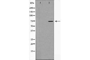 Western blot analysis of hnRNP M expression in HT29 cells,The lane on the left is treated with the antigen-specific peptide.