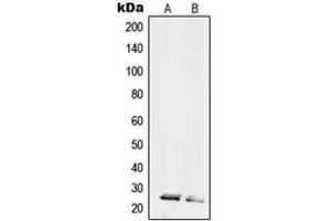 Western blot analysis of RPL10L expression in HL60 (A), HeLa (B) whole cell lysates. (RPL10L Antikörper  (C-Term))