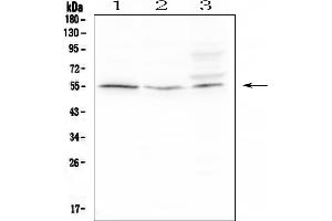 Western blot analysis of ACKR2 using anti-ACKR2 antibody (ABIN6719286).