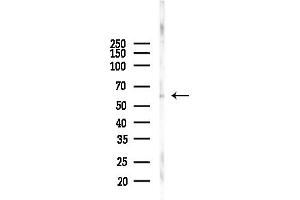 Western blot analysis of lysates from COLO205 cells(UV,30 min treatment), using Phospho-PKM2 (Ser37) Antibody at 1/1000 dilution.