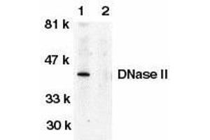 Western blot analysis of DNase II in human spleen tissue lysate in the absence (lane 1) or presence (lane 2) of blocking peptide with DNase II antibody at 1μg/ml. (DNASE2 Antikörper)
