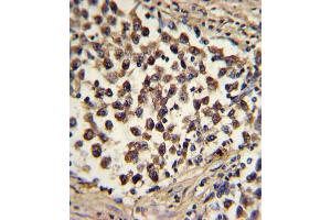 Immunohistochemistry (IHC) image for anti-SNAI antibody (ABIN2912021) (SNAI Antikörper)