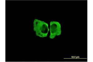 Immunofluorescence of monoclonal antibody to MSRA on HeLa cell. (MSRA Antikörper  (AA 1-100))