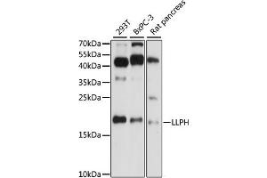 Western blot analysis of extracts of various cell lines, using LLPH antibody (ABIN7268289) at 1:1000 dilution.