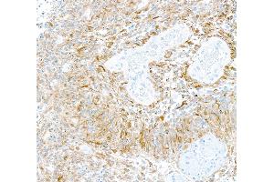 Immunohistochemistry (IHC) image for anti-Tubulin, beta 3 (TUBB3) (AA 400-450) antibody (ABIN7453957)
