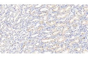 Detection of IL18 in Rabbit Kidney Tissue using Polyclonal Antibody to Interleukin 18 (IL18) (IL-18 Antikörper  (AA 32-192))