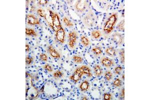 Immunohistochemistry (IHC) image for anti-Gap Junction Protein, beta 1, 32kDa (GJB1) (AA 215-231), (Middle Region) antibody (ABIN3042611)