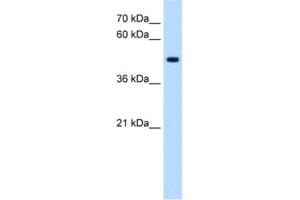 Western Blotting (WB) image for anti-serine/threonine/tyrosine Kinase 1 (STYK1) antibody (ABIN2463064) (STYK1 Antikörper)