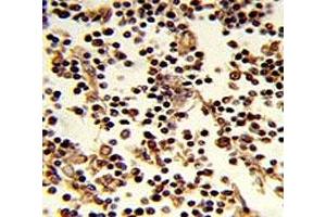Immunohistochemistry (IHC) image for anti-CD19 Molecule (CD19) (AA 143-172) antibody (ABIN3030362)