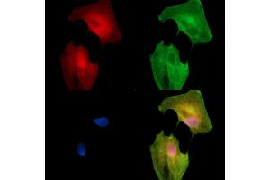 ABIN7096400 and ABIN7100464 staining  cells by IF/ICC. (PRAM1 Antikörper)