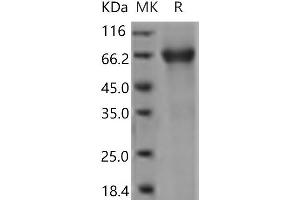 Western Blotting (WB) image for Interleukin 7 Receptor (IL7R) (Active) protein (Fc Tag) (ABIN7321220) (IL7R Protein (Fc Tag))