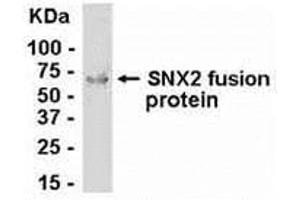 Western Blotting (WB) image for anti-Sorting Nexin 2 (SNX2) (AA 1-519) antibody (ABIN2468137) (Sorting Nexin 2 Antikörper  (AA 1-519))