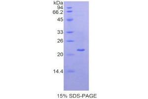 SDS-PAGE (SDS) image for Laminin, gamma 1 (LAMC1) (AA 1228-1404) protein (His tag) (ABIN2121527) (Laminin gamma 1 Protein (AA 1228-1404) (His tag))