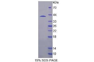 Image no. 1 for SH3-Domain Binding Protein 2 (SH3BP2) (AA 1-259) protein (His tag) (ABIN6237540) (SH3BP2 Protein (AA 1-259) (His tag))